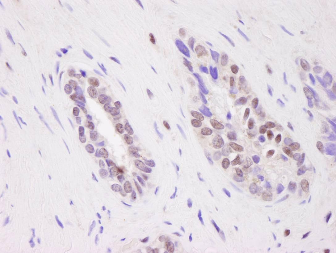Immunohistochemistry (Formalin/PFA-fixed paraffin-embedded sections) - Anti-CARM1 antibody (AB84370), expandable thumbnail