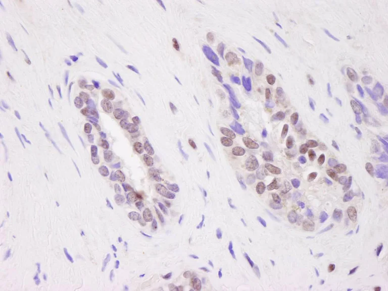 Immunohistochemistry (Formalin/PFA-fixed paraffin-embedded sections) - Anti-CARM1 antibody (AB84370)