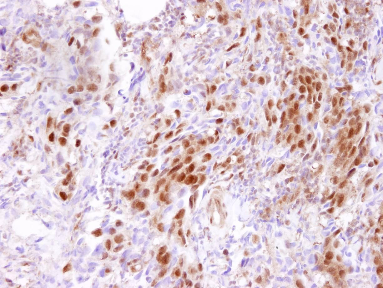 Immunohistochemistry (Formalin/PFA-fixed paraffin-embedded sections) - Anti-CARM1 antibody (AB84370), expandable thumbnail