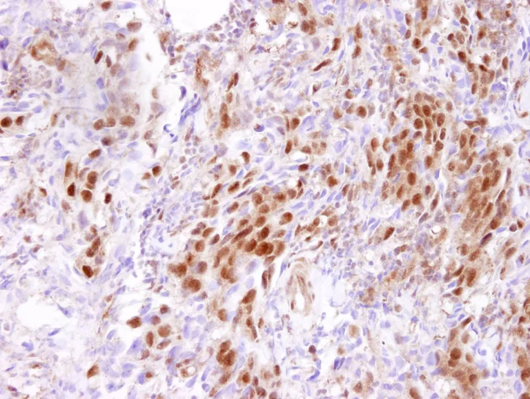 Immunohistochemistry (Formalin/PFA-fixed paraffin-embedded sections) - Anti-CARM1 antibody (AB84370)