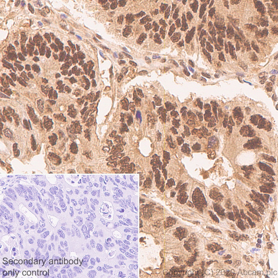 Immunohistochemistry (Formalin/PFA-fixed paraffin-embedded sections) - Anti-CARM1 antibody [EPR23678-113] (AB243638)