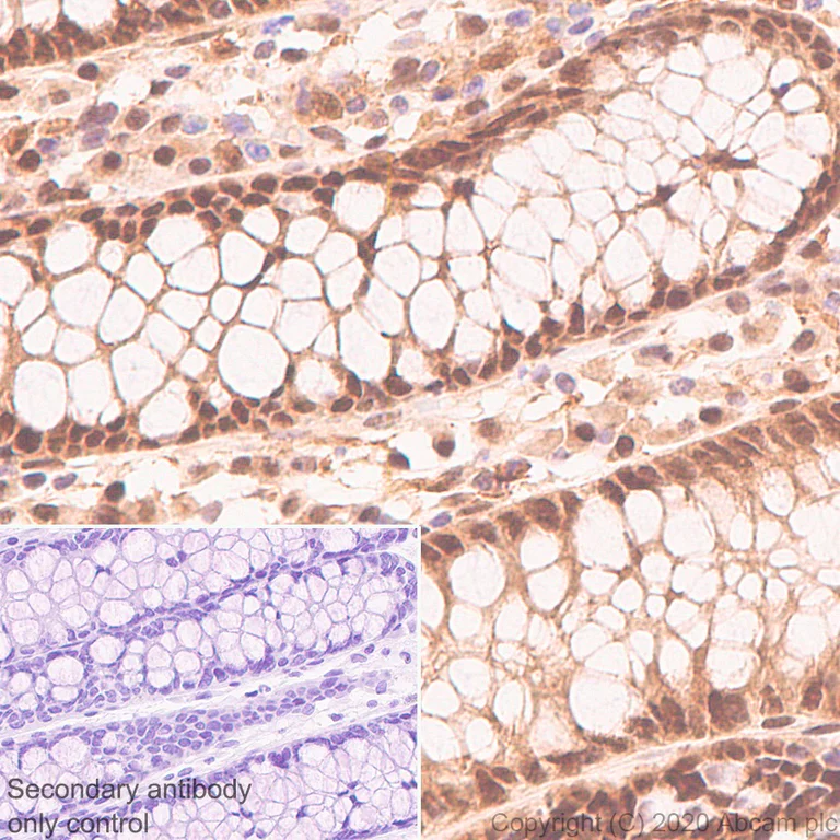 Immunohistochemistry (Formalin/PFA-fixed paraffin-embedded sections) - Anti-CARM1 antibody [EPR23678-113] - BSA and Azide free (AB279344)