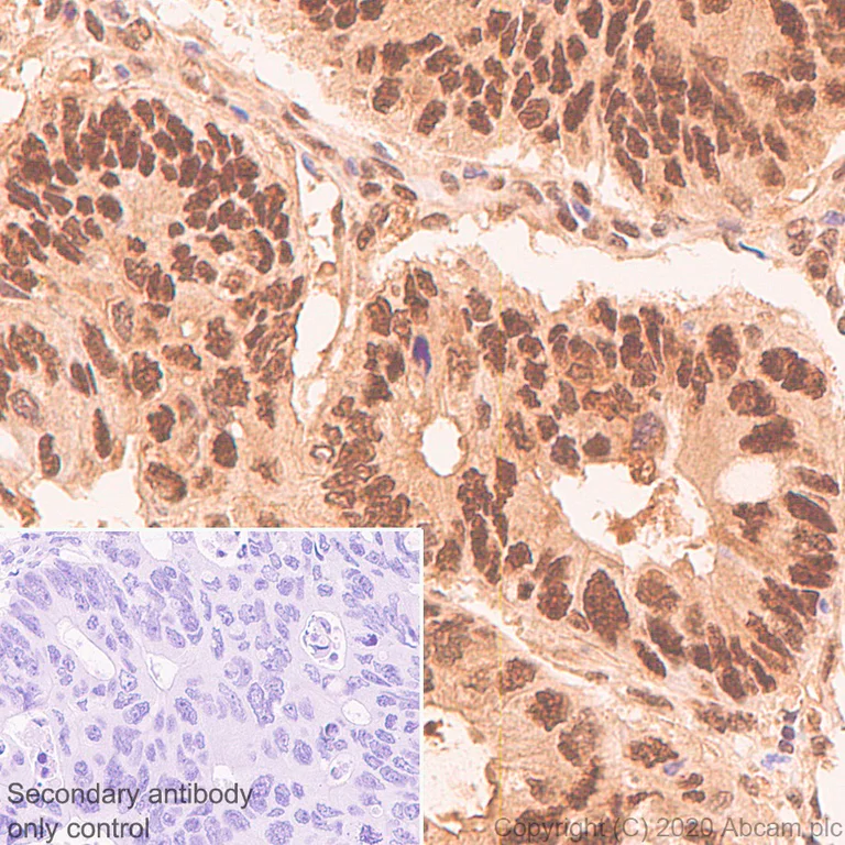 Immunohistochemistry (Formalin/PFA-fixed paraffin-embedded sections) - Anti-CARM1 antibody [EPR23678-113] - BSA and Azide free (AB279344)
