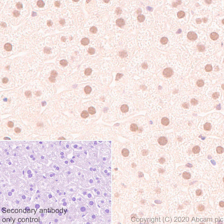 Immunohistochemistry (Formalin/PFA-fixed paraffin-embedded sections) - Anti-CARM1 antibody [EPR23678-113] - BSA and Azide free (AB279344)