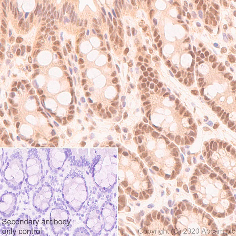 Immunohistochemistry (Formalin/PFA-fixed paraffin-embedded sections) - Anti-CARM1 antibody [EPR23678-113] - BSA and Azide free (AB279344)