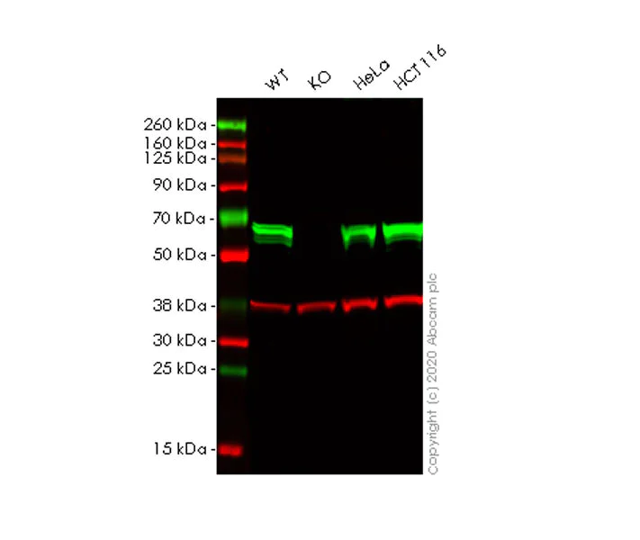 Western blot - Anti-CARM1 antibody [EPR23678-113] - BSA and Azide free (AB279344)
