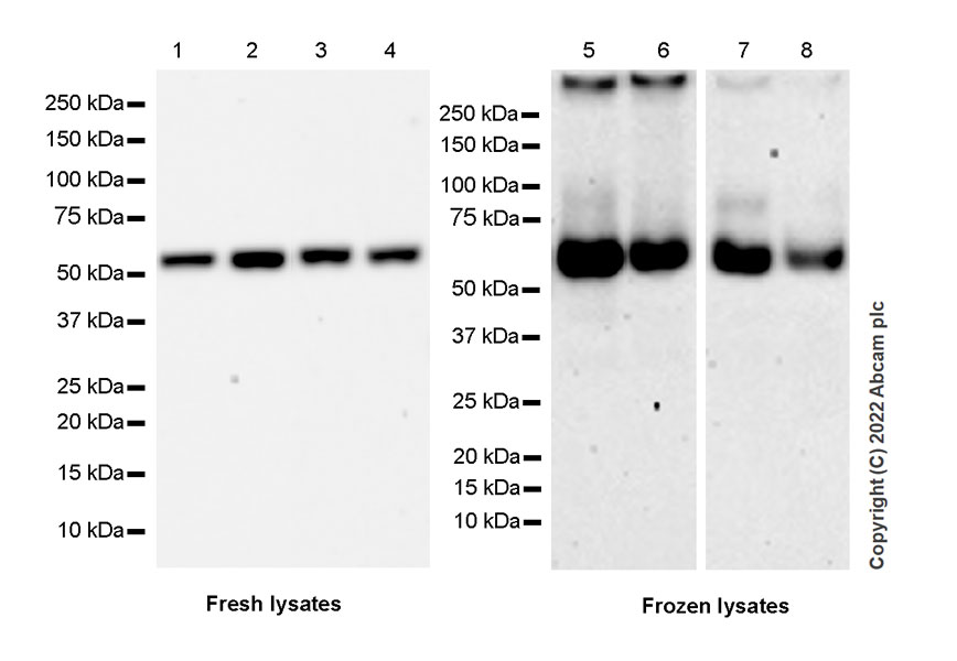 Western blot - Anti-CARM1 antibody [EPR26711-36] (AB307091), expandable thumbnail