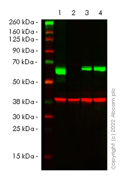 Western blot - Anti-CARM1 antibody [EPR26711-36] - BSA and Azide free (AB307092)