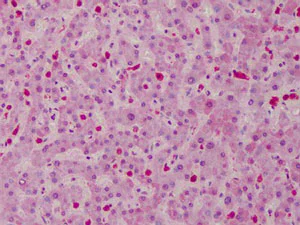 Immunohistochemistry (Formalin/PFA-fixed paraffin-embedded sections) - Anti-Carma 1/CARD11 antibody (AB113409)