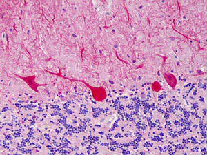 Immunohistochemistry (Formalin/PFA-fixed paraffin-embedded sections) - Anti-Carma 1/CARD11 antibody (AB113409)