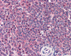 Immunohistochemistry (Formalin/PFA-fixed paraffin-embedded sections) - Anti-Carma 1/CARD11 antibody (AB115471)