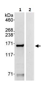 Immunoprecipitation - Anti-Carma 1/CARD11 antibody (AB264296)