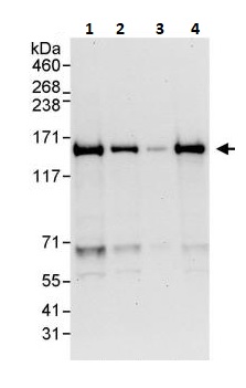 Western blot - Anti-Carma 1/CARD11 antibody (AB264296)