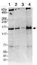 Western blot - Anti-Carma 1/CARD11 antibody (AB91463)