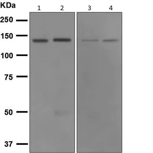 Western blot - Anti-Carma 1/CARD11 antibody [EPR2557] (AB124730)