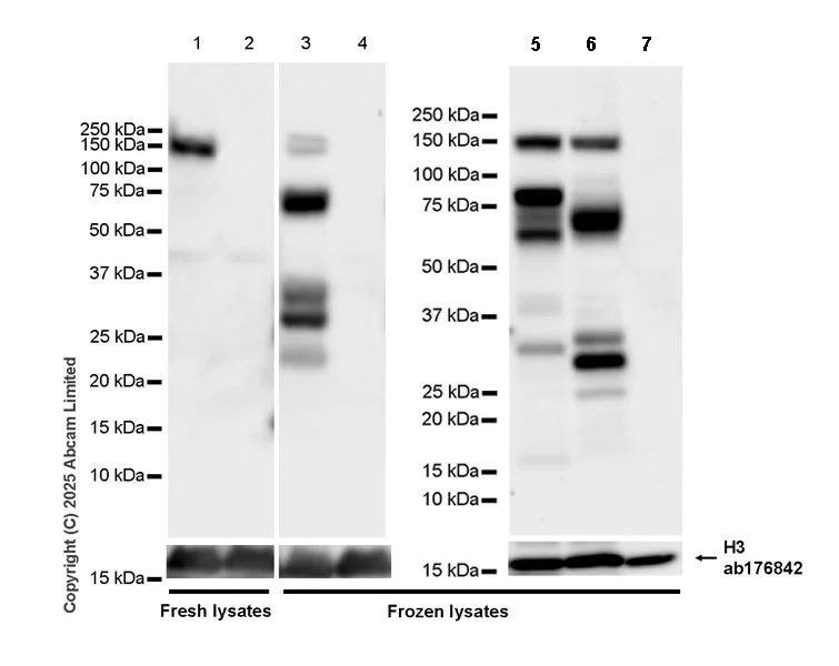 Western blot - Anti-Carma 1/CARD11 antibody [EPR29724-541] (AB324567)