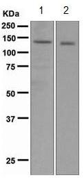 Western blot - Anti-Carma 1/CARD11 antibody [EPR3177] (AB109310)