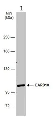 Western blot - Anti-Carma 3 antibody (AB137383)