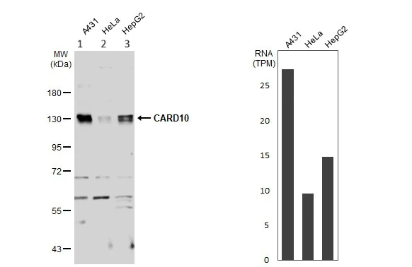 Western blot - Anti-Carma 3 antibody (AB137383)