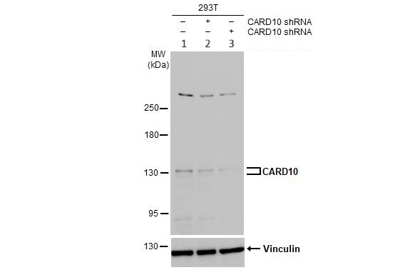 Western blot - Anti-Carma 3 antibody (AB137383)