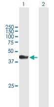 Western blot - Anti-CARNS1 antibody (AB167240)