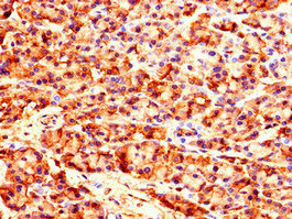 Immunohistochemistry (Formalin/PFA-fixed paraffin-embedded sections) - Anti-CARS antibody (AB235536)