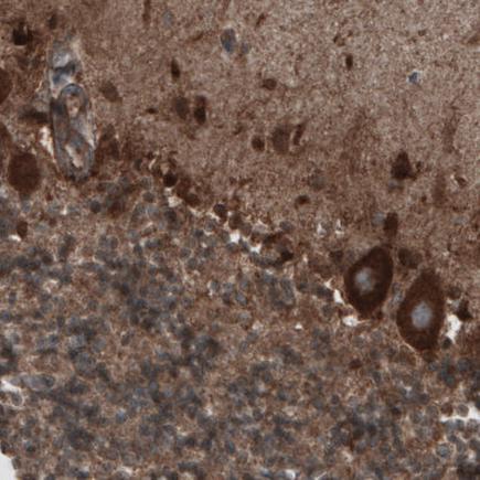 Immunohistochemistry (Formalin/PFA-fixed paraffin-embedded sections) - Anti-CARS antibody [CL2302] (AB242361)