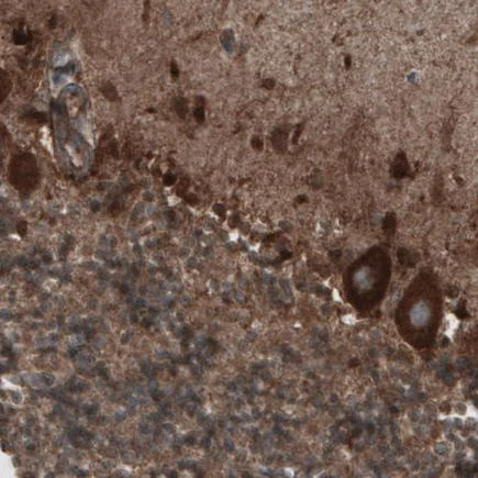 Immunohistochemistry (Formalin/PFA-fixed paraffin-embedded sections) - Anti-CARS antibody [CL2302] (AB242361)