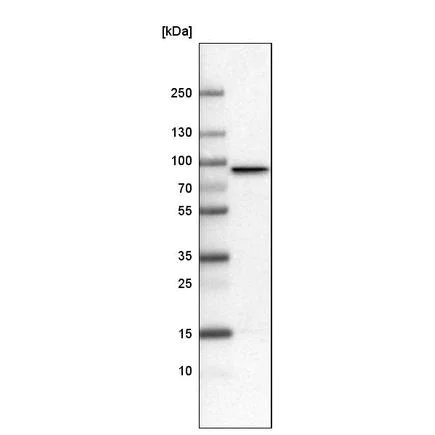Western blot - Anti-CARS antibody [CL2302] (AB242361)