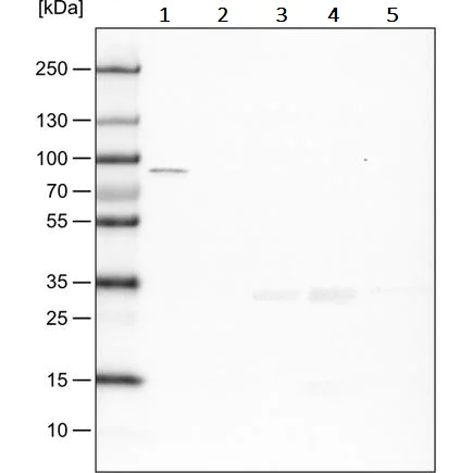 Western blot - Anti-CARS antibody [CL2302] (AB242361)