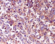 Immunohistochemistry (Formalin/PFA-fixed paraffin-embedded sections) - Anti-CARS antibody [EPR7121] (AB126714)