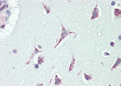 Immunohistochemistry (Formalin/PFA-fixed paraffin-embedded sections) - Anti-CASC4 antibody - C-terminal (AB230522)