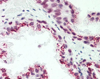 Immunohistochemistry (Formalin/PFA-fixed paraffin-embedded sections) - Anti-CASC4 antibody - C-terminal (AB230522)
