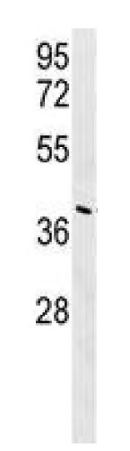 Western blot - Anti-CASC4 antibody - C-terminal (AB230522)