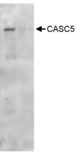 Immunoprecipitation - Anti-CASC5/KNL1 antibody (AB70537)