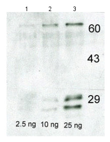 Western blot - Anti-Casein antibody (AB166596), expandable thumbnail