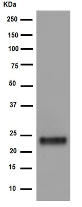 Western blot - Anti-Casein antibody [EPR15762] - N-terminal (AB188331)