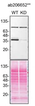 Western blot - Anti-Casein Kinase 1 alpha antibody [EPR19824] (AB206652)
