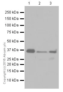 Western blot - Anti-Casein Kinase 1 alpha antibody [EPR19824] (AB206652)