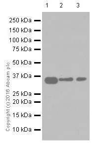 Western blot - Anti-Casein Kinase 1 alpha antibody [EPR19824] (AB206652)