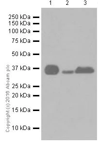Western blot - Anti-Casein Kinase 1 alpha antibody [EPR19824] (AB206652)