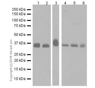Western blot - Anti-Casein Kinase 1 alpha antibody [EPR19824] (AB206652)