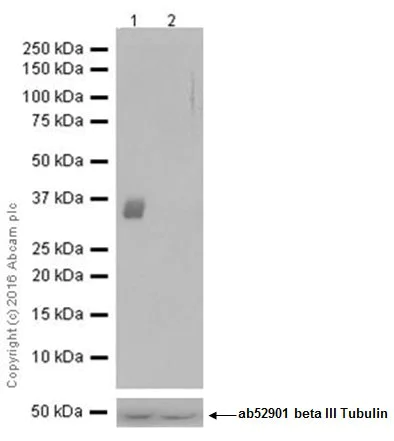 Western blot - Anti-Casein Kinase 1 alpha antibody [EPR19824] - BSA and Azide free (AB223144)