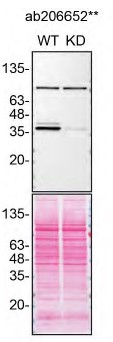 Western blot - Anti-Casein Kinase 1 alpha antibody [EPR19824] - BSA and Azide free (AB223144)