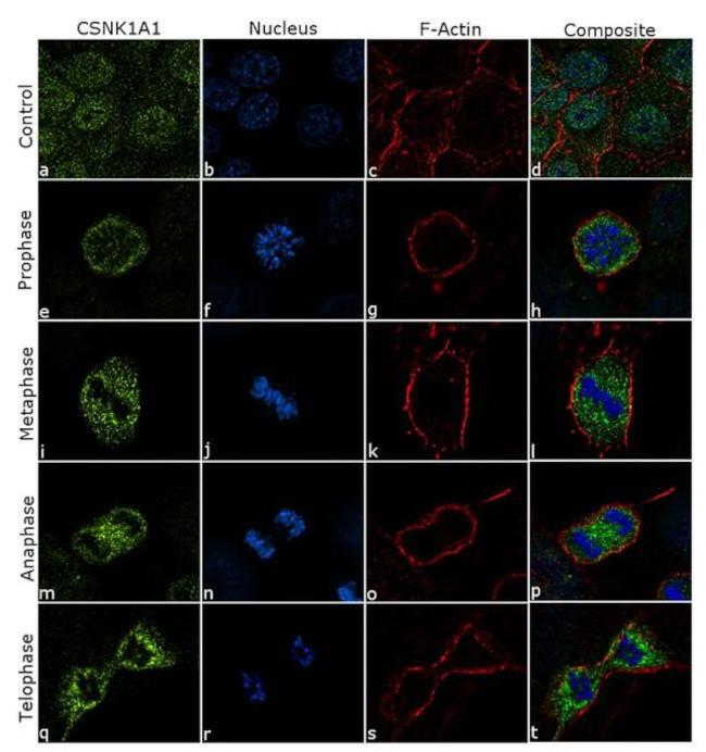 Immunocytochemistry/ Immunofluorescence - Anti-Casein Kinase 1 alpha Antibody [RP23040231] (AB313493), expandable thumbnail