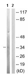 Western blot - Anti-Casein Kinase 1 alpha (phospho T321) antibody (AB63559)