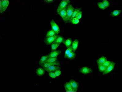 Immunocytochemistry/ Immunofluorescence - Anti-Casein Kinase 1 delta/CSNK1D antibody (AB236601)