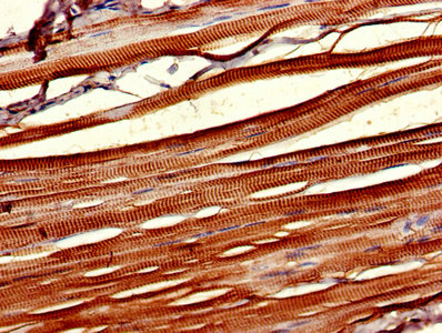 Immunohistochemistry (Formalin/PFA-fixed paraffin-embedded sections) - Anti-Casein Kinase 1 delta/CSNK1D antibody (AB236601)