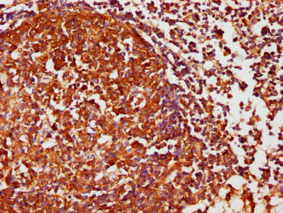 Immunohistochemistry (Formalin/PFA-fixed paraffin-embedded sections) - Anti-Casein Kinase 1 delta/CSNK1D antibody (AB236601)