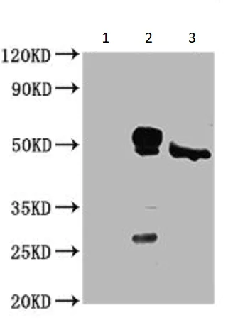 Immunoprecipitation - Anti-Casein Kinase 1 delta/CSNK1D antibody (AB236601)
